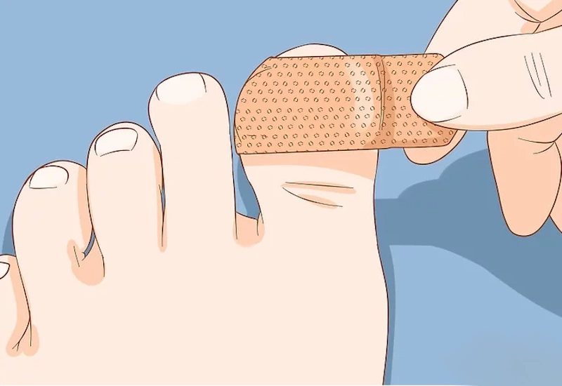 Chăm Sóc Móng Chân Bị Bật: Các Bước Đơn Giản Để Có Móng Khỏe Mạnh